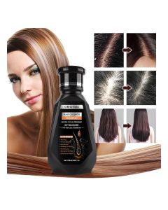 Anti Hair Loss Biotin Shampoo with DHT Blocking Technology for Thinning Hair, Professional Scalp Treatment for Oil Control, Flake Removal, Frizz Reduction, Stronger Roots, and Long-Lasting Hair Growth Results