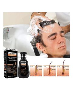 Hair Growth Shampoo with Biotin DHT Blocker Technology, Daily Anti Hair Loss Cleanser for Weak Roots, Thinning Hair, Scalp Irritation, Dandruff Control, Deep Repair, and Long-Term Hair Strength